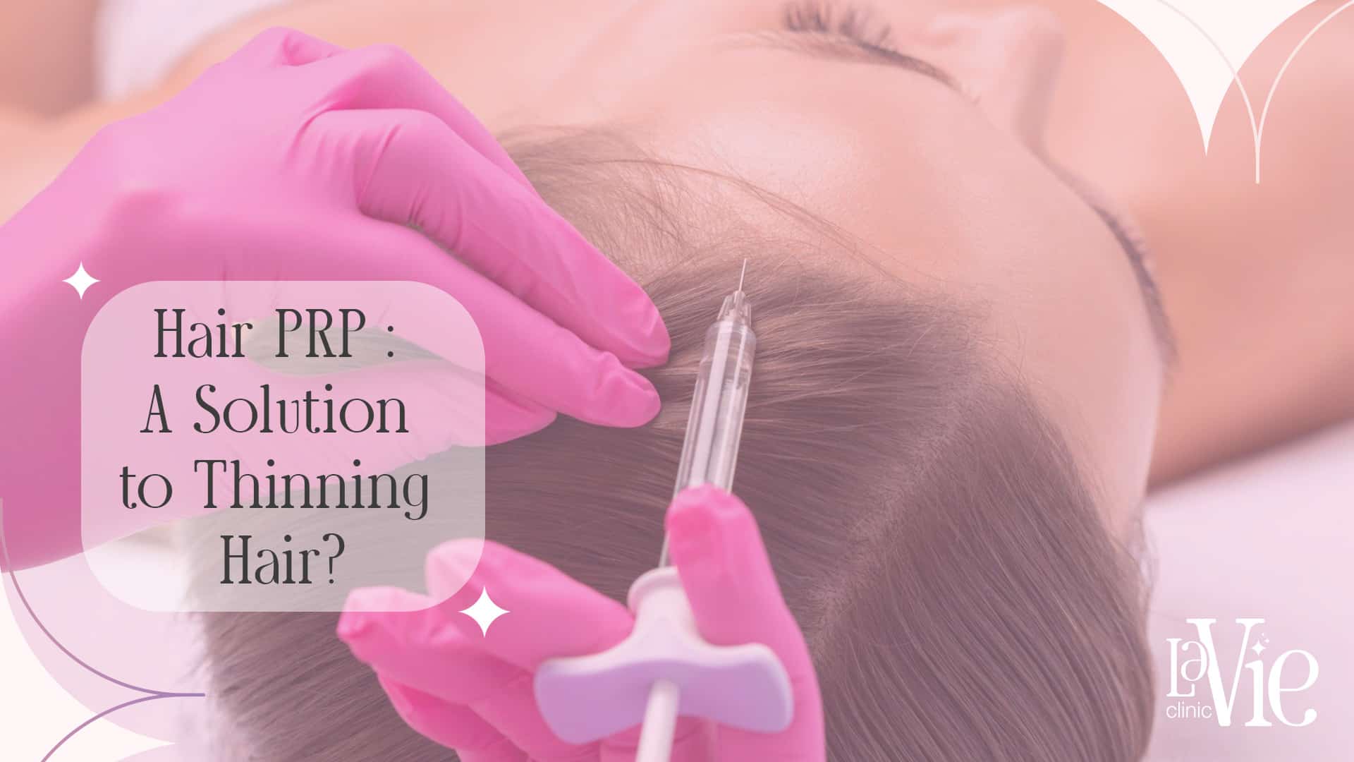 Hair Prp Rochester Hills A Solution To Thinning Hair 