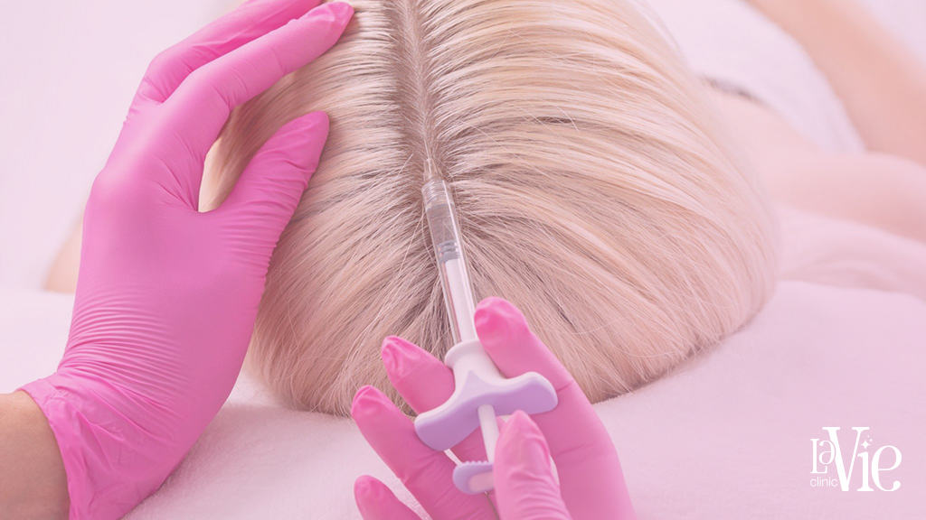 women laying in the La Vie Clinic Rochester Hills, while the specialist injects platelet-rich fibrin (PRF) solution into the scalp to stimulate hair growth