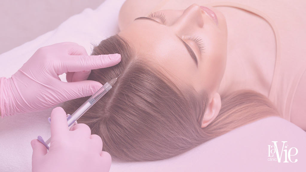 women laying in the La Vie Clinic Rochester Hills, while the specialist injects platelet-rich fibrin (PRF) solution into the scalp to stimulate hair growth