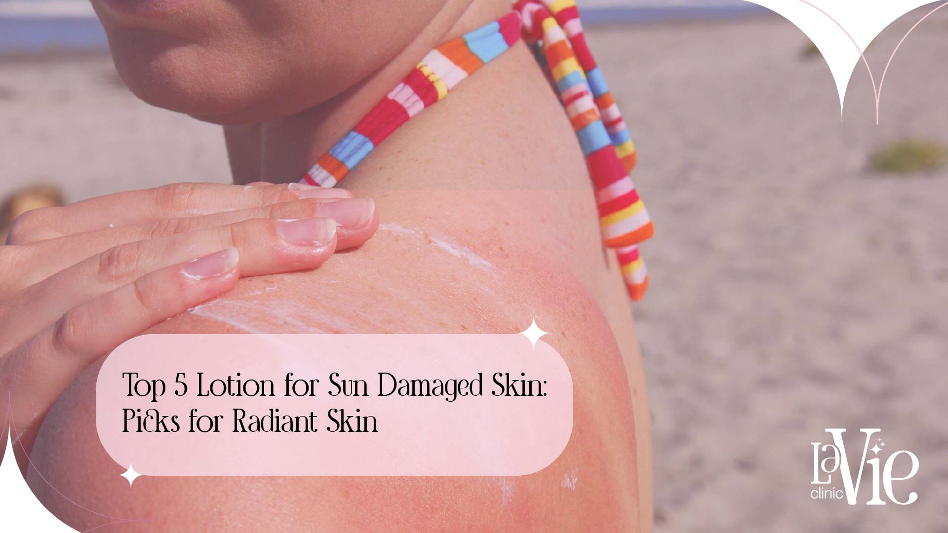 Top 5 Lotions For Sun Damaged Skin Picks For Radiant Skin