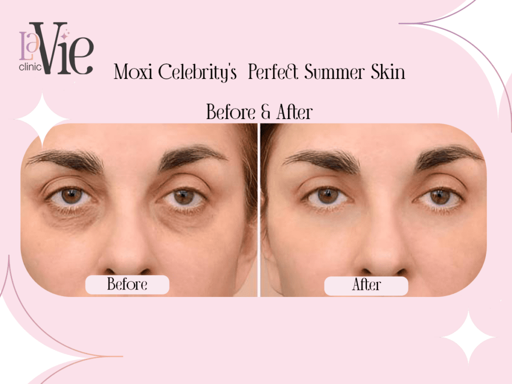 Celebrity's Perfect Summer Skin Treatment