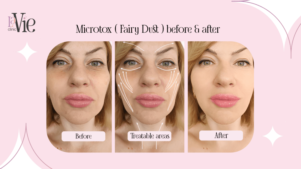 Microtox results before and after 