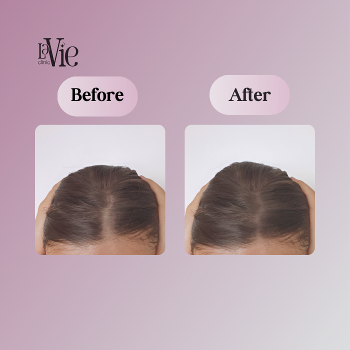 Combining Treatments for Triple the Results